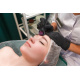 Derma Roller 0,5mm - jehlová mezoterapie